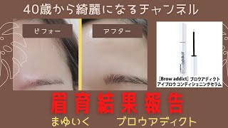 眉毛が増えた！！眉育結果報告！ブロウアディクト眉毛美容液