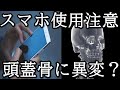 スマートフォンの使用で角が生えることが判明!?