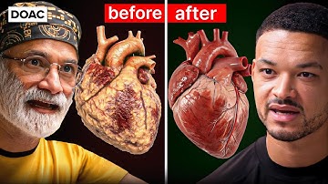 Insulin Doctor: The Fastest Way To Burn Dangerous Visceral Fat! I