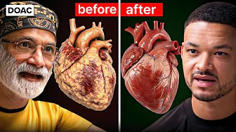 Insulin Doctor: The Fastest Way To Burn Dangerous Visceral Fat! I'm Finding Mould In My Patients!