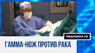 Бессимптомная менингиома: лечить или не наблюдать? | Медицина KZ