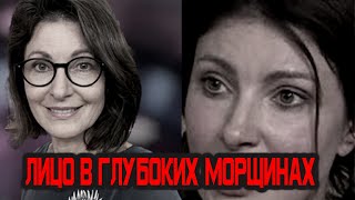 Резко постаревшая Макеева ужаснула народ