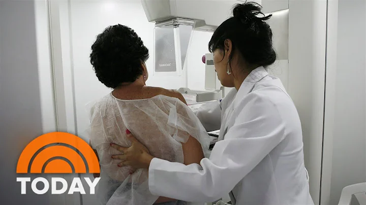 Mammogram age recommendation lowered from 50 to 40