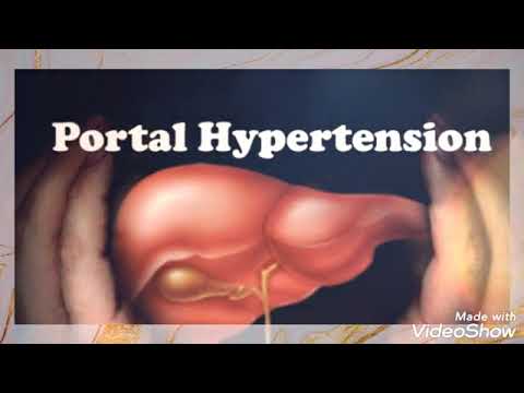 Portal Hypertension