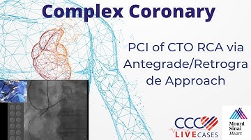 PCI of CTO RCA via Antegrade/Retrograde Approach - November 19, 2013 Webcast Video