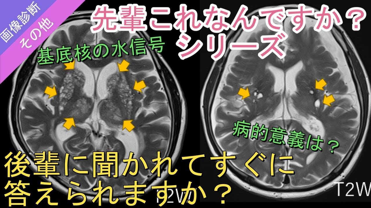 先輩これなんですか？シリーズ⓷