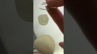 Набір Acne Off від MyIdi