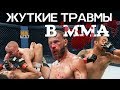 ЖУТКИЕ ТРАВМЫ В ММА! "ЛОМАЙ МЕНЯ ПОЛНОСТЬЮ" / ВЫПУСК ОТ MMATRASH