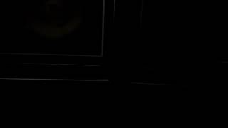 Анатолий Крупнов (Черный Обелиск) -Я Остаюсь!- Холодные дни (2018) [Vinyl]