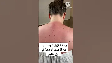 وصفة تزيل الجلد الميت من الجسم 
