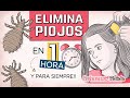 💇🏻‍♀️🔥 3 Remedios para ELIMINAR PIOJOS y Liendres en 1 HORA y para Siempre!!!