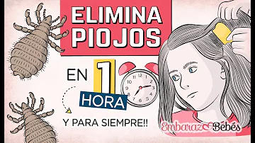 ¿Cómo quitar los piojos rápido y fácil?