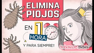 Polo licencia Elemental 💇🏻‍♀️🔥 3 Remedios para ELIMINAR PIOJOS y Liendres en 1 HORA y para  Siempre!!! - YouTube