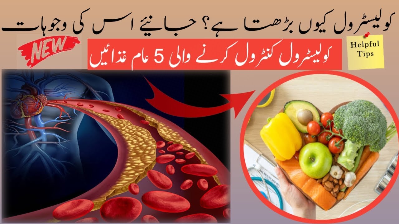 Five foods that control your cholesterolhigh cholestrol symptoms