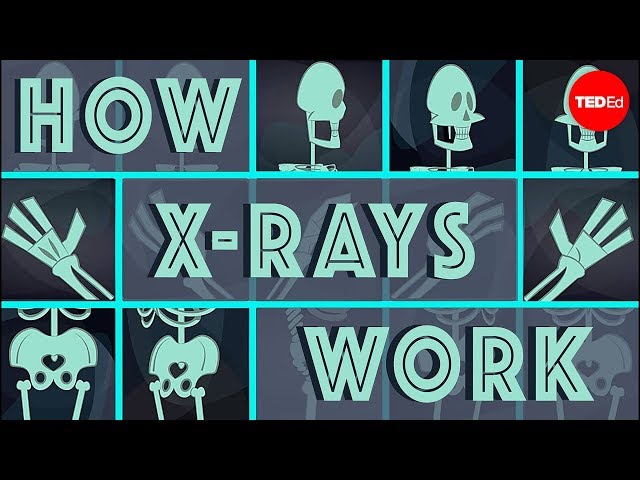 X - Ray