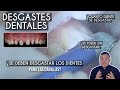 ¿Se deben desgastar los dientes para las carillas? 🤔 ¿Se hace en todos los casos?- Odontología Láser