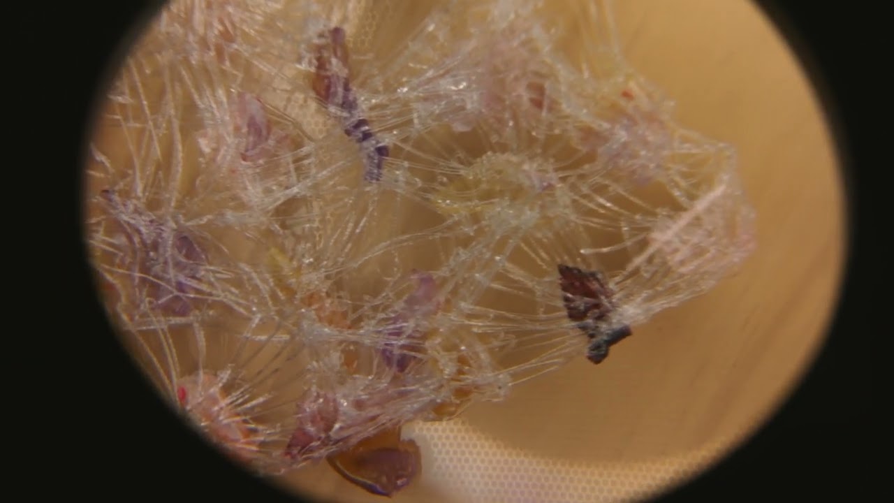 Solán de Cabras | 10 Emociones, 10 Rosas | Raquel Buj: Ansiedad