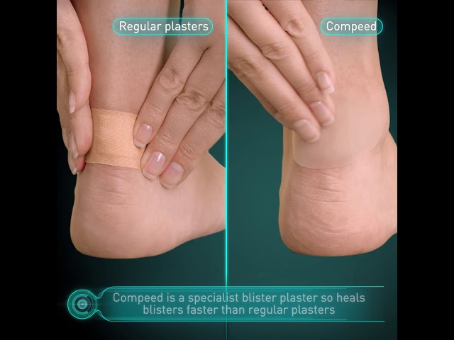 Why Use Compeed Instead Of Regular Plasters Compeed Foot Treatment Blister Plasters Youtube Why Use Compeed Instead Of Regular Plasters Compeed Foot Treatment Blister Plasters Youtube