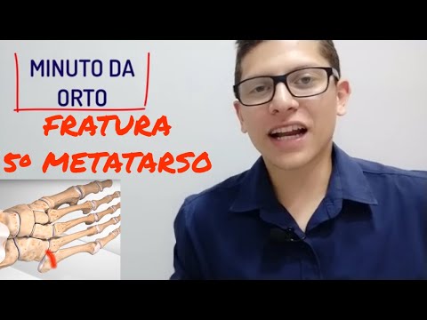 FRATURA POR AVULSÃO