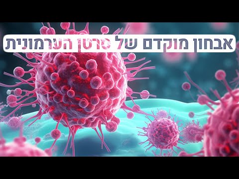 אבחון מוקדם של סרטן הערמונית עם מומחי איכילוב