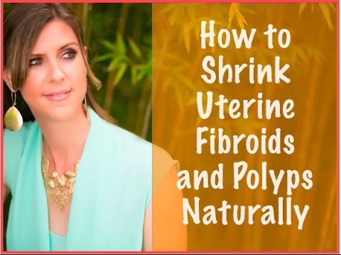 How To Get Rid Of Stomach Polyps Naturally How To Get Rid Of Stomach Polyps Naturally