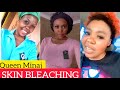 Queen minaj facebook live on skin bleaching  bmw  age