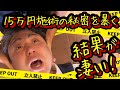 【整形級?】芸能人が多数メンテナンスに通う小顔矯正を体験してきた!|顔でお悩みの方必見!|はりねずみ美容鍼でおなじみカドモリ先生|