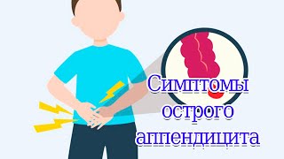 Симптомы острого аппендицита  Умаров Джавлон #аппендицит #ситковский #Раздольский #Щеткин