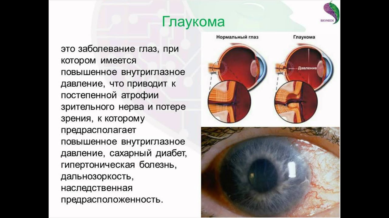 Машинное зрение программы