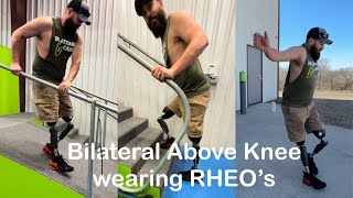 Bilateral above knee amputee wearing Rheo knees