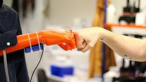 Science Cafe: 3D Printing and Orthopedic Surgery