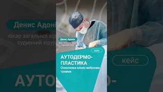 Аутодермопластика | лікування вибухового поранення з ураженням ліктьового суглоба | Денис Адонін