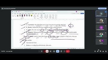 Skin Cancer Detection - Part 1