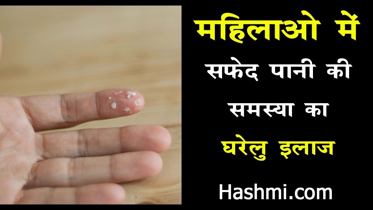 mahilao me safed pani ki samasya Hone Ka Ilaj YouTube