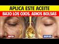 El COLÁGENO NATURAL MEJOR ayuda a eliminar las BOLSAS DE LOS OJOS y las ARRUGAS