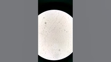 Old Blood under the microscope #laboratory #microscope #mls #cls #blood #bloodcells #SSTtube #CELLS