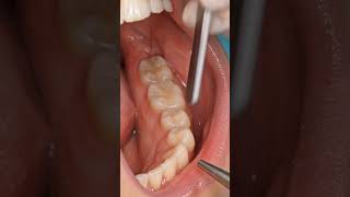 Ghoda ghas chabate hue ro raha tha — enamel points ne bana diya tha muh mein chakuo ka jungle