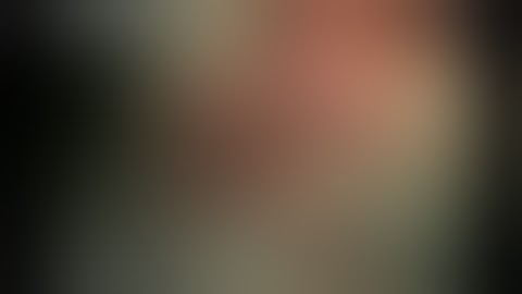 Miconvey Endoscopic  stapler video