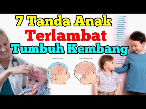 Video: Akankah Anak Saya Lebih Besar dari Fase Kuda? 20 Tanda yang Harus Diperhatikan