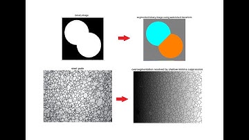 Image Segmentation Using Watershed Transform