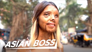 Meet Anmol: An Acid Attack Survivor Model From India