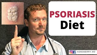 The Psoriasis Diet. Better than Medicine?? 2024