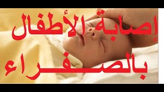 كيفية علاج الصفار عند المواليد.