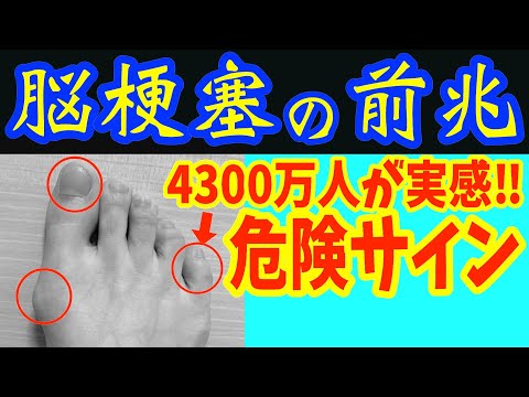 絶対に見逃してはいけない高血圧が進むと現れる超危険な脳卒中の要注意サインと4300万人が効果を実感‼コンビニやスーパーで買える血圧を下げて血管ツルツルにする薬に依存しない最強の食べ物&飲み物