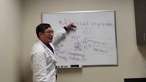 Aberrant Regeneration of CN III