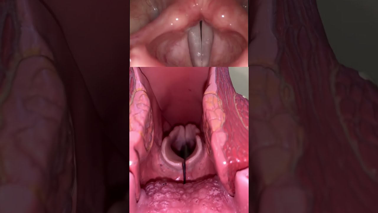 Live View Of The Vocal Cords Anatomy Medical Funfacts