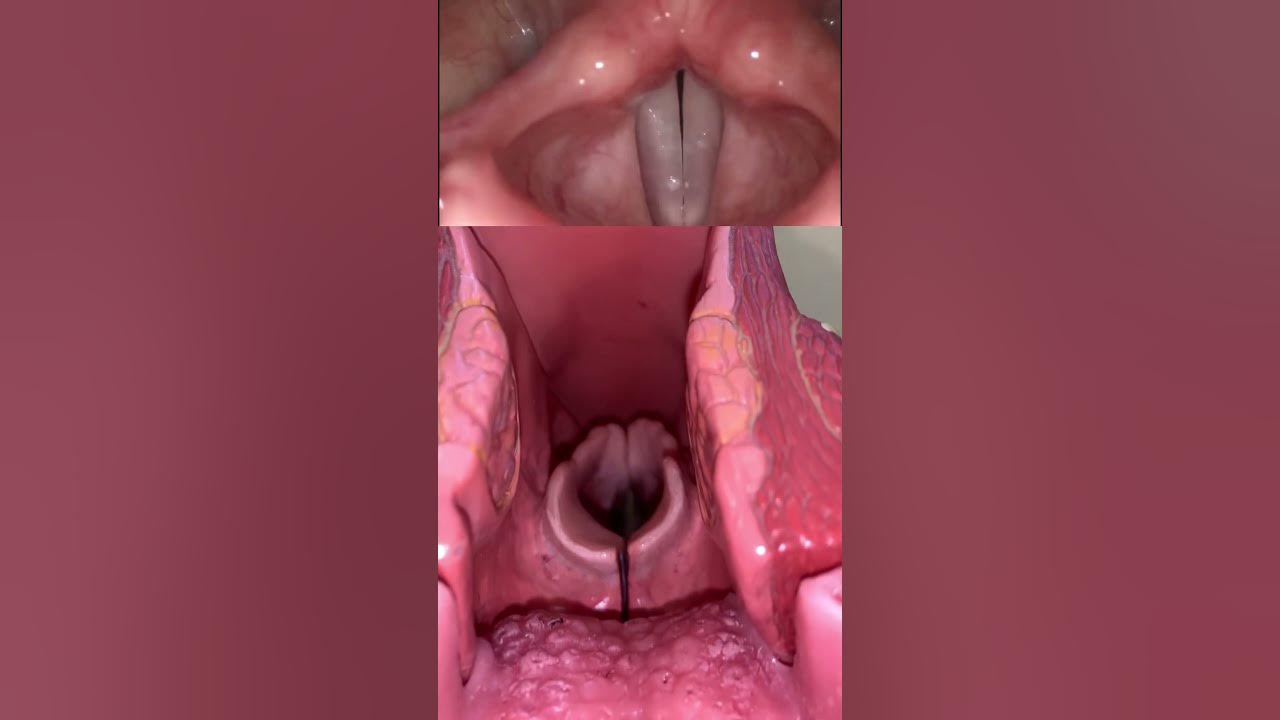 Live view of the vocal cords! #anatomy #medical #funfacts Live view of the vocal cords! #anatomy #medical #funfacts