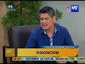 Good Morning Kuya: Ringworm - Symptoms and Treatment