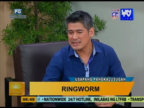 Video: Paano Malaman Kung Mayroon kang Ringworm: 10 Hakbang (na may Mga Larawan)
