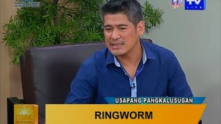 Good Morning Kuya: Ringworm  Symptoms and Treatment